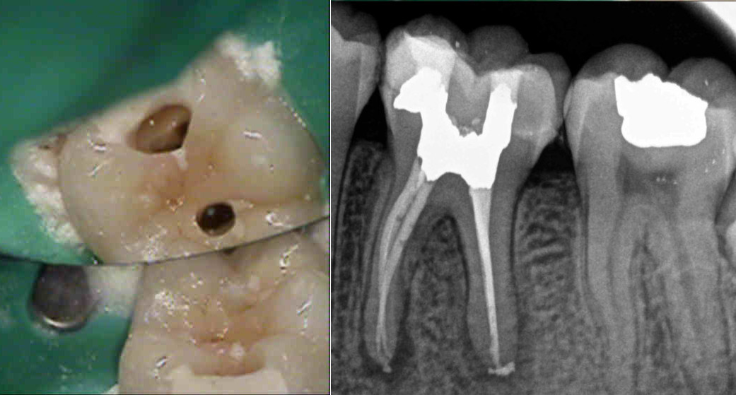 X-ray